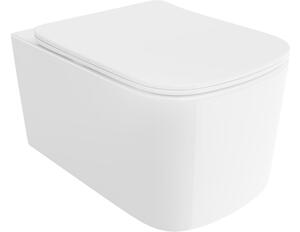 Mexen Vivo wc sospeso Rimless Tornado con coprivaso slim a chiusura rallentata, duroplast, bianco lucido - 30610200T